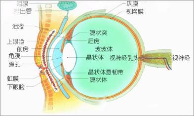 為什么會(huì)發(fā)展成高度近視？